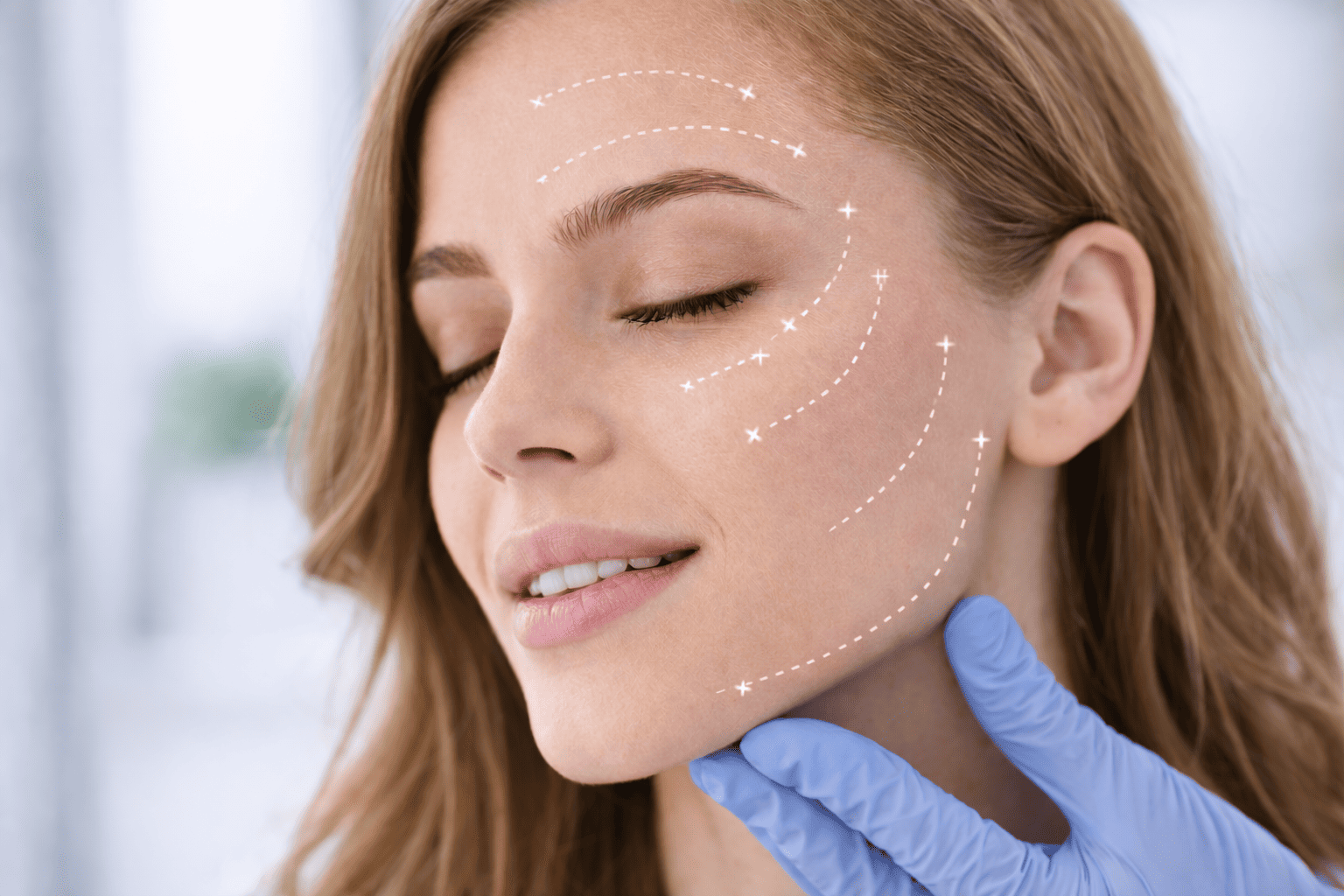Harmonização facial